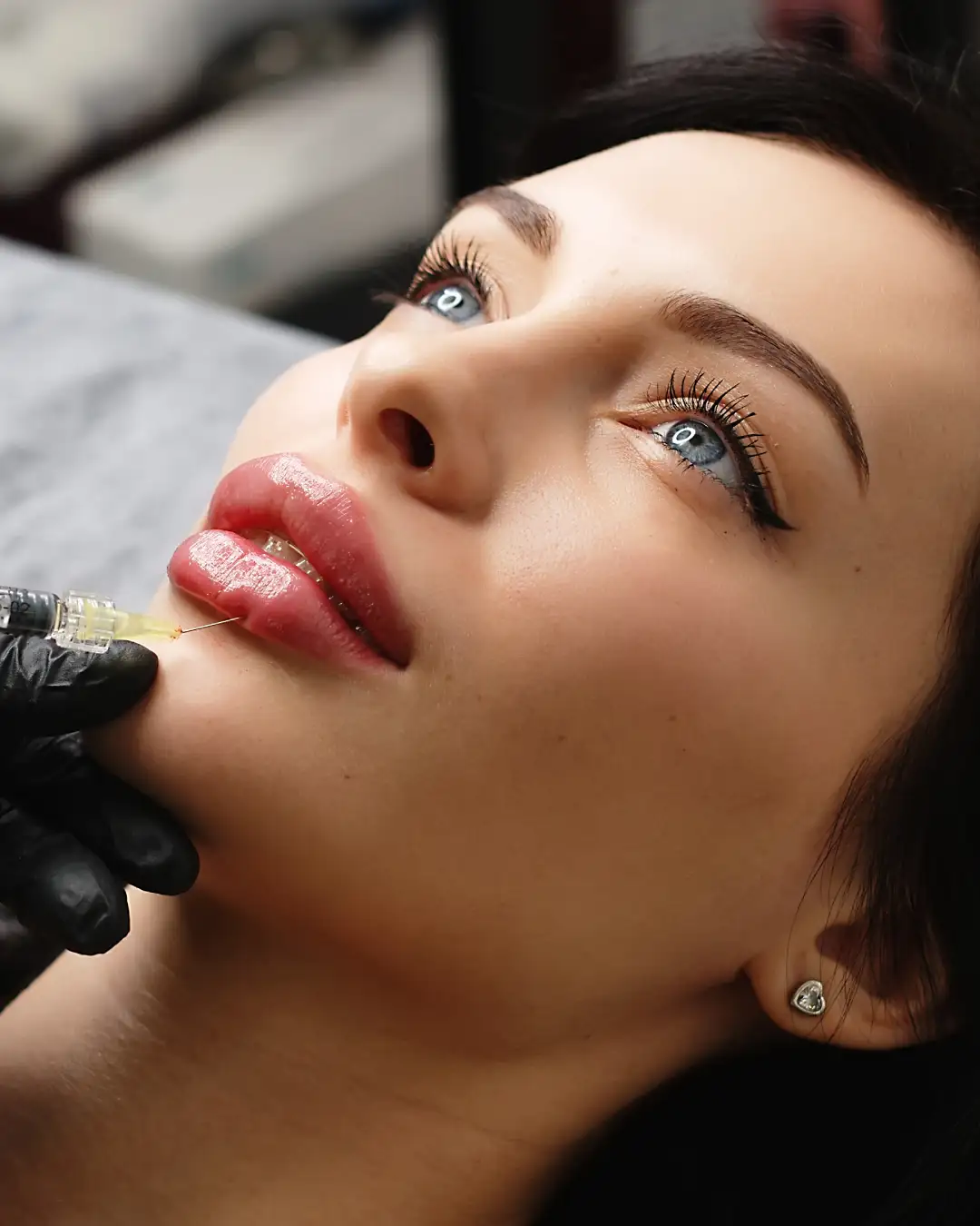 Lip Fillers benefits at Bosthetics Boutique Med Spa in Lacey, WA