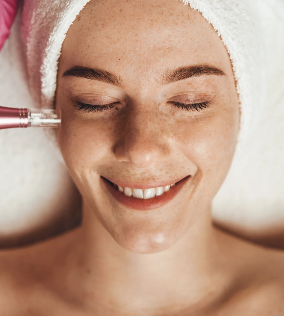 MDPen Microneedling at Bosthetics Boutique Med Spa in Lacey, WA