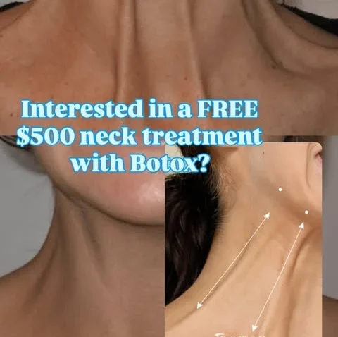 botox media at Bosthetics Boutique Med Spa